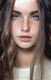 Freckles of Grace